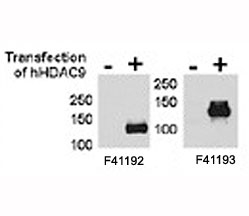 HDAC9 antibody <a href=../tds/hdac9-antibody-f41192>NSJ# F41192</a> and NSJ# F41193 were tested by WB and IP-WB using HeLa and HeLa-HDAC9 transfected cells. Both antibodies detect the protein in transfected cells but not non-transfected.