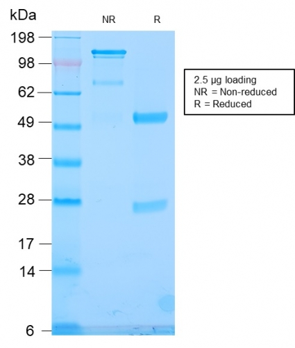 Anti-TLE1 Antibody [TLE1/2946R]