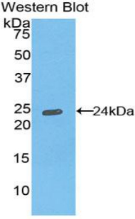 Western Blot; Sample: Recombinant protein.