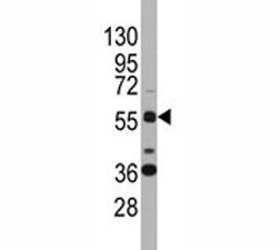 Western blot analysis of SOX9 antibody and K562 lysate.