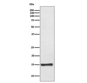 Western blot testing of human fetal heart lysate with FABP4 antibody. Predicted molecular weight ~15 kDa.