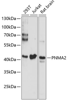 Anti-PNMA2 Antibody