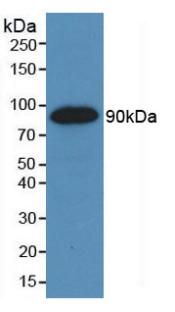 Western Blot; Sample: Recombinant VEGFR2, Human.