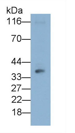Western Blot; Sample: Jurkat cell lysate Primary Ab: 0.6µg/ml Mouse Anti-Human CD86 Antibody Second Ab: 0.2µg/mL HRP-Linked Caprine Anti-Mouse IgG Polyclonal Antibody (Catalog: SAA544Mu19)