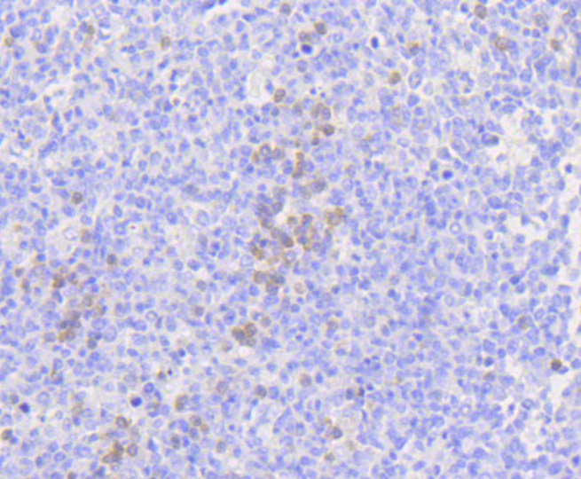 Anti-MLKL Antibody [Assigned #A11458]
