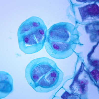 Lily Anther, Pollen Tetrads, c.s., 12 µm Microscope Slide