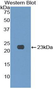 Western Blot; Sample: Recombinant protein.