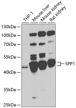 Anti-SPP1 Antibody