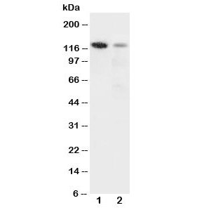 Western blot testing of Integrin alpha 3 antibody and Lane 1: rat heart; 2: HeLa cell lysate. Expected molecular weight: 119-150 kDa depending on glycosylation level.