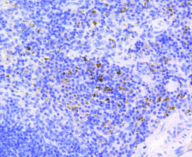 Anti-RB1 (phospho S807) Antibody