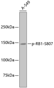 Anti-RB1 (phospho S807) Antibody
