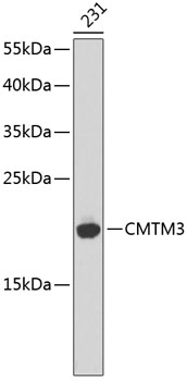 Anti-CMTM3 Antibody