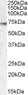 Anti-GABRA4 Antibody