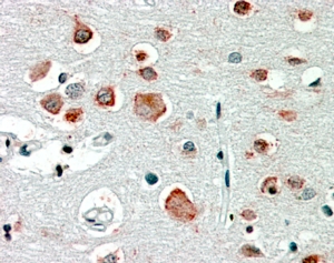 Anti-GABRA4 Antibody