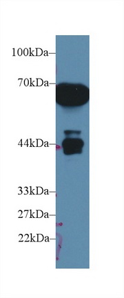 Western Blot; Sample: Rat Serum; Primary Ab: 1µg/ml Rabbit Anti-Rat a1M Antibody Second Ab: 0.2µg/mL HRP-Linked Caprine Anti-Rabbit IgG Polyclonal Antibody