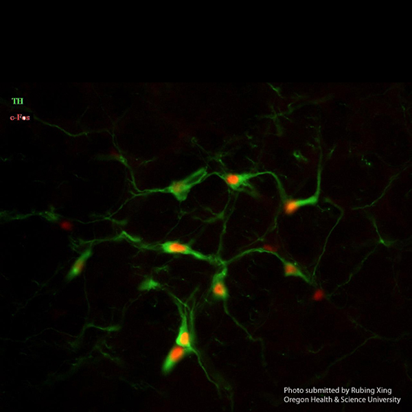 Tyrosine Hydroxylase Antibody