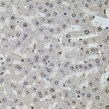 Anti-SET Antibody