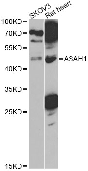 Anti-ASAH1 Antibody