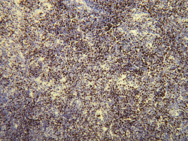 Anti-Ki-67 Antibody [C16-l]