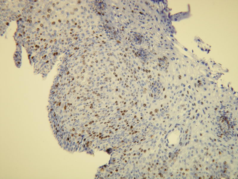 Anti-Ki-67 Antibody [C16-l]