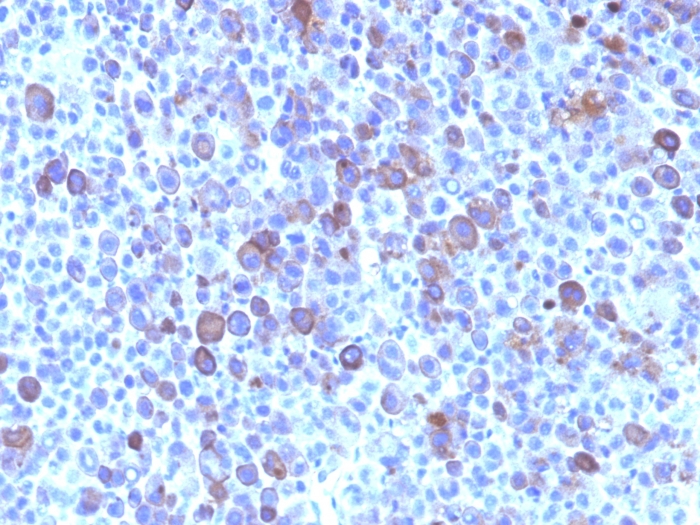 Anti-Glypican 3 Antibody [SPM595]