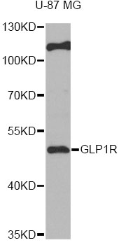 Anti-GLP1R Antibody