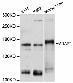 Anti-ARAP2 Antibody