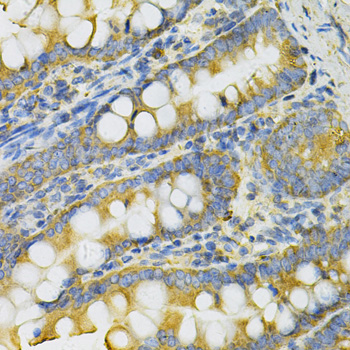Anti-PGK1 Antibody