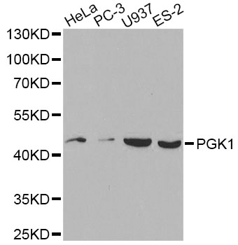 Anti-PGK1 Antibody