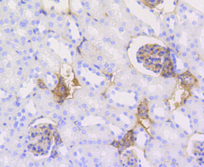 Anti-CALD1 Antibody [Assigned #A10768]