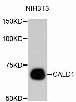 Anti-CALD1 Antibody [Assigned #A10768]