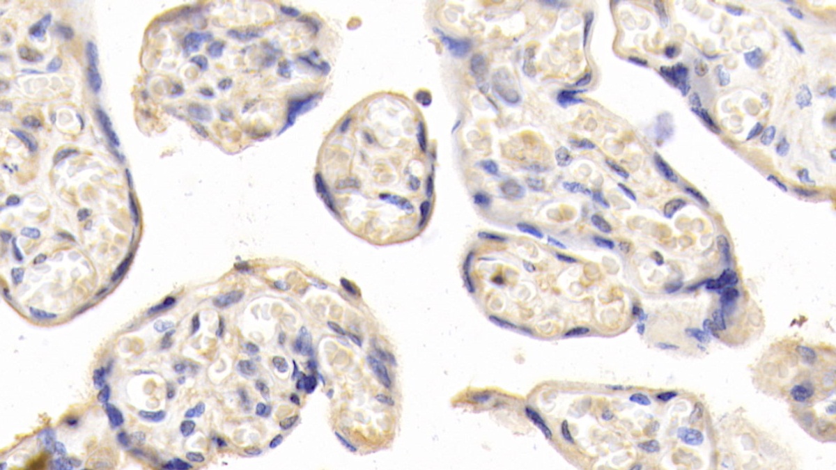 DAB staining on IHC-P; Samples: Human Placenta Tissue;  Primary Ab: 20μg/ml Mouse Anti-Human LEP Antibody Second Ab: 2µg/mL HRP-Linked Caprine Anti-Mouse IgG Polyclonal Antibody (Catalog: SAA544Mu19)