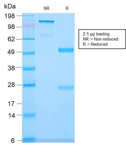 Anti-CD79b Antibody [IGB/2940R] - BSA and Azide free