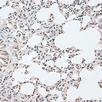 Anti-CBX6 Antibody