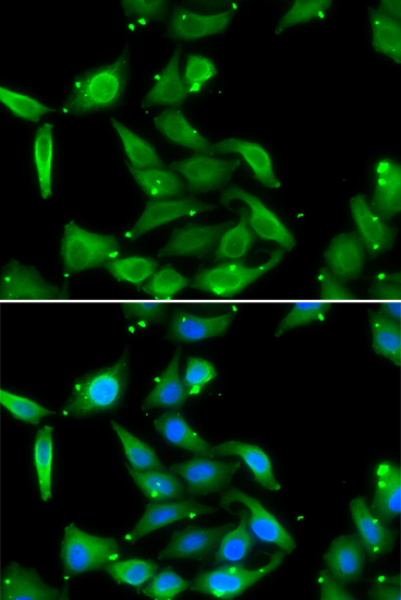 Anti-GAMT Antibody