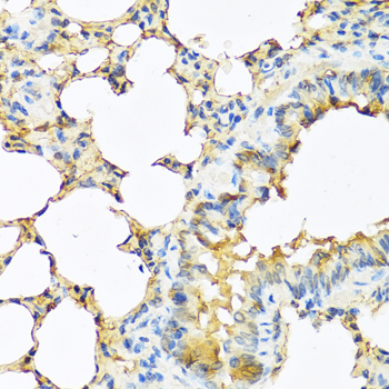 Anti-TSHB Antibody