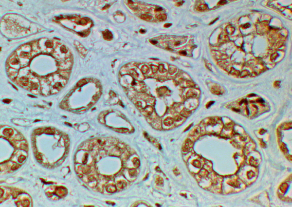 Anti-FZD4 Antibody
