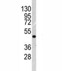 Western blot analysis of ILK1 antibody and NCI-H460 lysate. Expected molecular weight: 51-59 kDa.