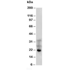 Western blot testing of FGF4 antibody and HeLa cell lysate