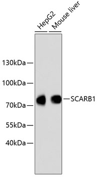 Anti-SCARB1 Antibody [Assigned #A10799]
