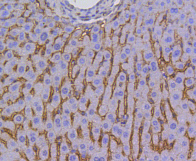 Anti-SCARB1 Antibody [Assigned #A10799]