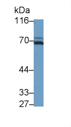 Western Blot; Sample: Recombinant protein.