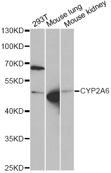 Anti-CYP2A6 Antibody