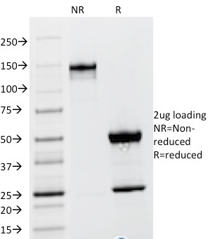 Anti-TSH beta Antibody [TSHb/1317] - BSA and Azide free