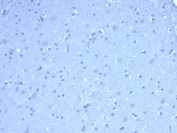 Negative control: IHC staining of FFPE human brain tissue using TOM1L1 antibody (clone TOM1L1/4690) at 2ug/ml in PBS for 30min RT. HIER: boil tissue sections in pH 9 10mM Tris with 1mM EDTA for 20 min and allow to cool before testing.