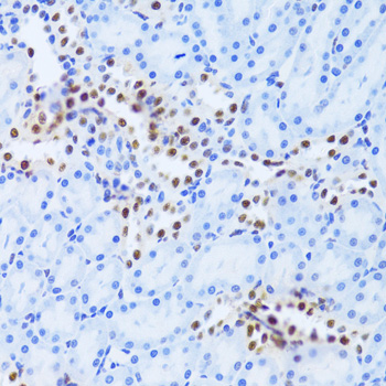 Anti-ANP32A Antibody