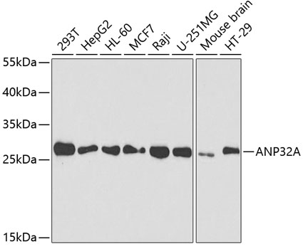 Anti-ANP32A Antibody
