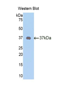 Western Blot; Sample: Recombinant protein.