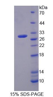 Figure. SDS-PAGE