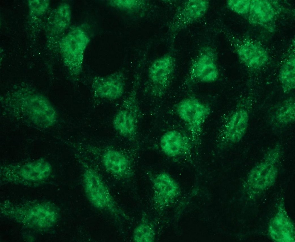 Anti-p38 beta Antibody [E13-Q]